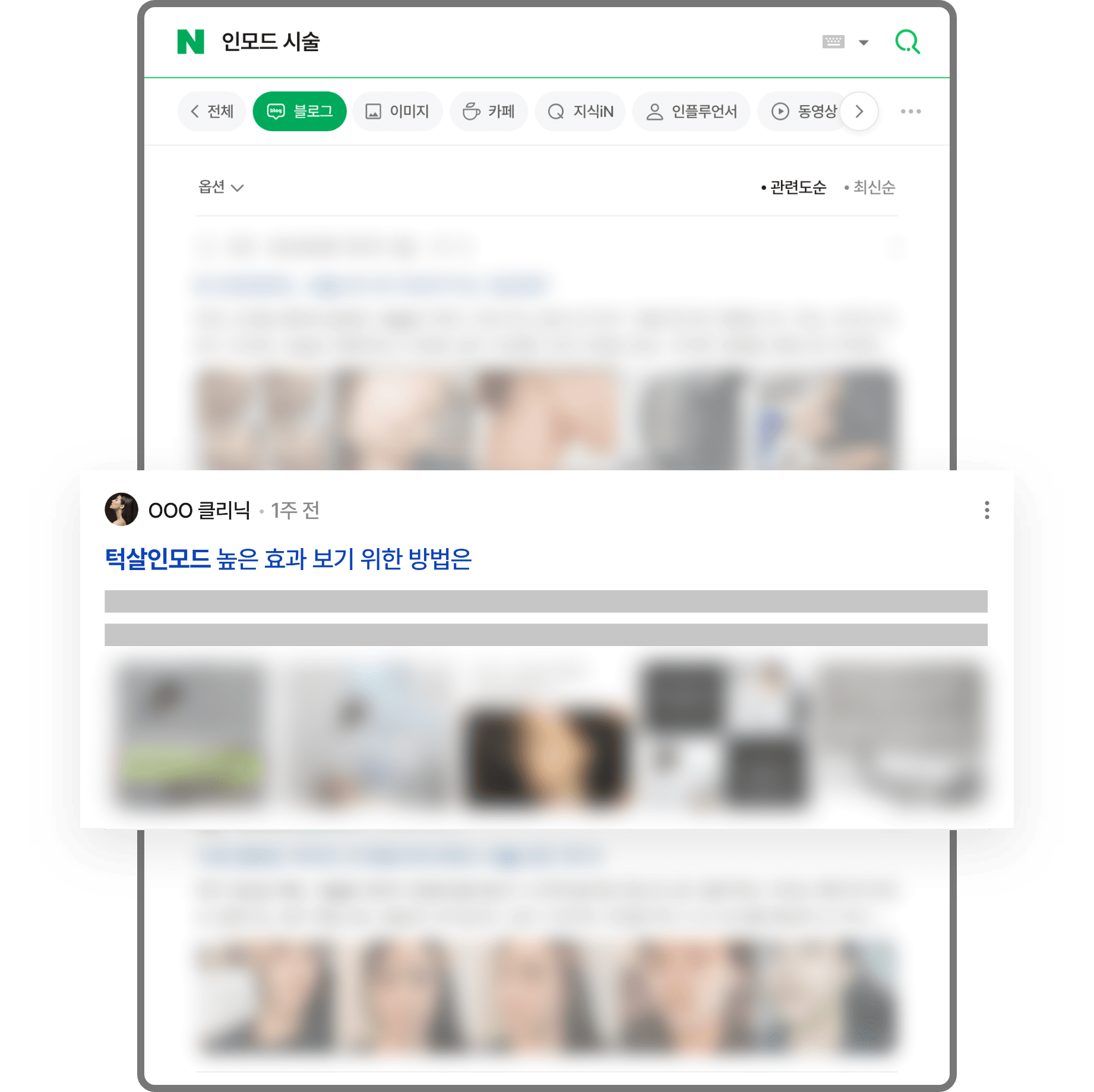인모드시술